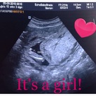  its a girl!