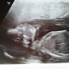 20 wkn 