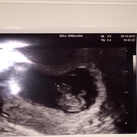 Eerste echo  28 okt 2015.. Eerste echo