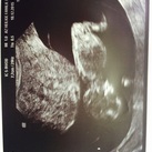 11w5d 