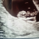 eerste echo echo van 17 de 2015