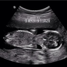 16w0d 