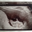 Het is een jongen!! :-) 