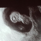 baby1. 