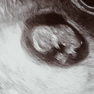 baby 2.  