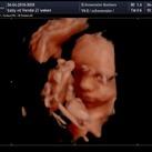 3D echo Lief lief mannetje