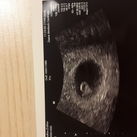 6w3d 