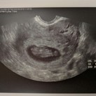 9w 3d 