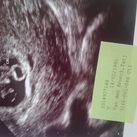 Eerste echo 7 w 1d 