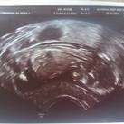 baby Jayden wij zijn vandaag op controle geweest en hebben te horen gekregen dat wij een zoontje verwachten we hebben besloten om ons kleine jongen Jayden te noemen <3 uitgerekend op 20/04/2017 ;) 