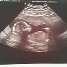 Geslachtsbepaling 2/12/16 En we krijgen een....
Jongen!!<3
Met 15+1 de echo gehad