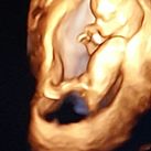 Ukkie 11w2d 