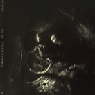  Echo 16w 2d