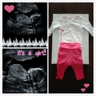 It's a girl!!! 