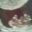 Echo 9w4dagen 