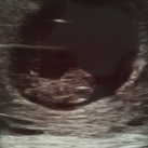 9 weken echo! 