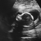  16 weken - it's a boy :D