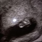 Voetje Een klein voetje kwam in beeld met echo maken..1cm groot
