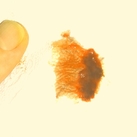 miskraam Gisterenavond verloren na heftige buikpijn hele avond.. Veel erger als menstruatie pijn aan de linkerkant