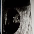 8 wkn +1 