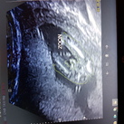 Its a boy! 