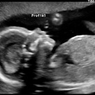 19w,0d 