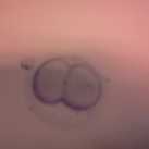 mijn 2 cellige emmy* van aug '12 Dit is mijn 2 cellige embryo die in augustus werd terug geplaatst maar die helaas niet warm bij zijn mamsie wilde blijven