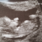 Nub theorie Hallo allemaal, 

Hier 11 weken en 2 dagen zwanger van ons wondertje. Kunnen jullie aan de hand van de nub theorie zien of t een jongetje of meisje is? 

