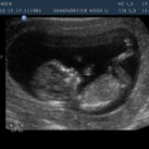 12 weken echo hier is ons meisje 13 weekjes :D