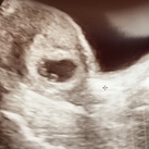Eerste echo 