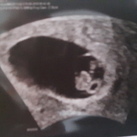Eerste echo 19-4 7w3d