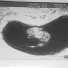 Ons kleine wondertje  8 weken echo, het was perfect! 