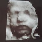 3D echo 27 weken 