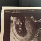 Echo op 10 weken echo op 10 weken! Baby bewoog al heel erg hard! :-) 
