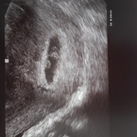 echo 6w3d 
