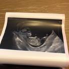 12 weken 3 dagen Baby op 12 weken en 3 dagen! 