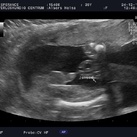 It's a boy! Wauw! Ja overduidelijk: we krijgen een zoon!!
