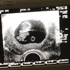  Echo 9+4 weken (29/11/2018) ivm bloedverlies, maar alles is goed!