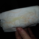  6 DPO - waterige witte afscheiding