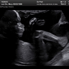  14/02/2019: 20+1 weken Lekker warm in mama's buik <3
