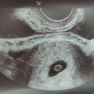 5w4d 