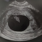 7w4d 