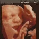  3D echo 31 weken <3