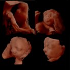 3d/4d echo 