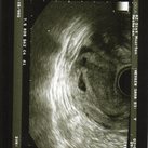 ons 2de kindje  5weken 6dagen oud ons kleine schat