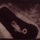 Baby 2: Echo 1 29/9/2020 7+5wkn Uitgerekende datum 13/5/2021