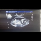  Ben zo nieuwsgierig of het een jongen of een meisje is ? 
Super fijn echo gehad gister met 13+3 