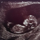  Kunnen jullie hier zien jongen of meisje? Deze foto is van 12wk