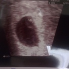 Echo 6 weken Bevesting zwangerschap :)