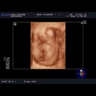  3D echo van onze prachtige zoon! Gemaakt door Dokter elvin papa, super mooi ruggetje en schattige billetjes